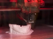 New 3D printer offering hope to patients needing b