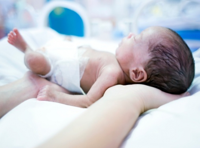 Premature babies are at greater risk of developmental and